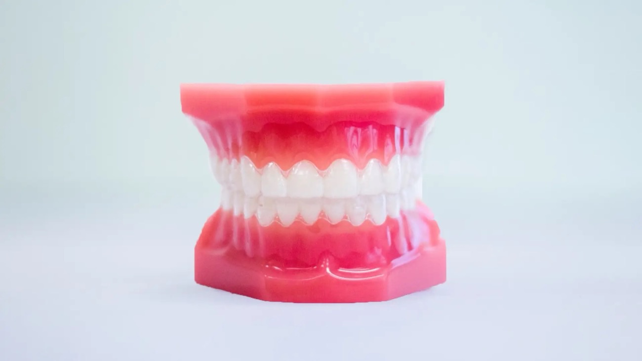 Invisalign at Papasikos Orthodontics